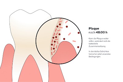 Plaque nach 48:00 h