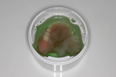 Die anschließende chemische Reinigung erfolgt alle zwei bis drei Tage, im Einzelfall auch täglich im Anschluss und zusätzlich zur mechanischen Reinigung mit einer Reinigungstablette und warmem Wasser in einer Prothesendose.