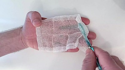 Mundschleimhäute: Reinigung & Befeuchtung ("Zuckerwatte"-Technik). Eine Kompresse 5x5 cm- achtlagig wird aufgeklappt und in den Handteller gelegt. Von schräg oben wird dann beginnend am Zeigefinger die Kompresse aufgenommen, am Borstenkopf umgeschlagen und dann zum Schaft hin gewickelt. So kann mit der Kompresse Speisereste, Schleim, Borken oder auch Zahnpasta sicher aus dem Mund herausgeholt oder auch Tee bzw. pflanzliche Öle in den Mund zur Pflege hineingebracht werden. Alternativ kann die Kompresse bei guter Kooperation auch einfach um den Finger gewickelt werden.