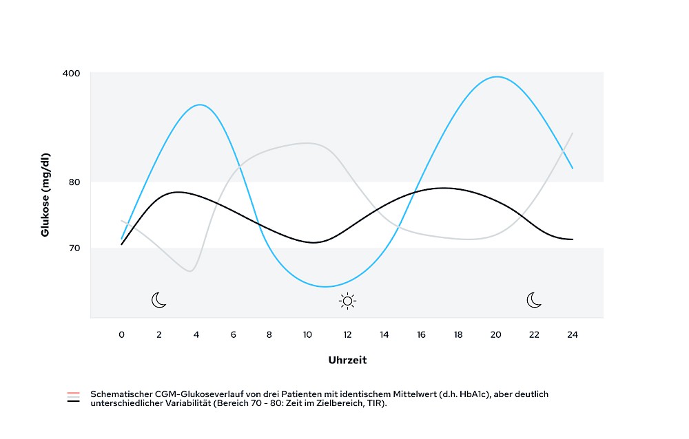 Schematischer CGM-Glukoseverlauf: Unterschiedliche Variabilität bei identischem Mittelwert