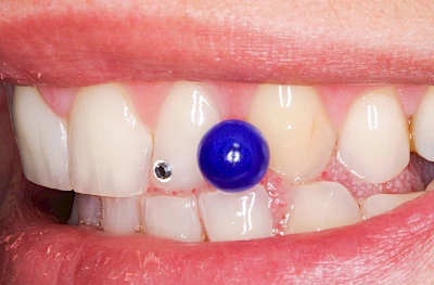 Beispiele: Schmuck