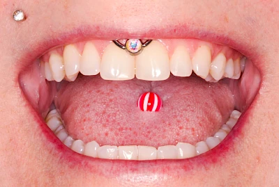 Beispiele: Schmuck