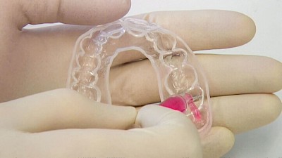 Beispiele: Zunge, Schleimhäute & Besonderheiten