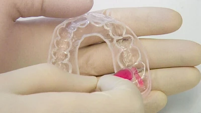 Beispiele: Zunge, Schleimhäute & Besonderheiten