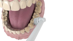 Elektrische Zahnbürsten