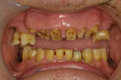 Beispiele: Abnutzung