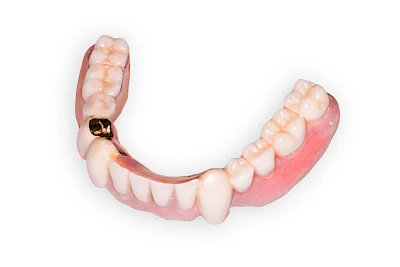 Beispiele: Wundheilungsstörung