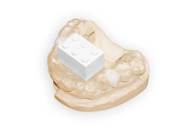 Beispiele: Implantatplanung