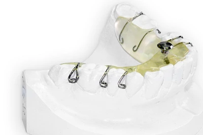 Beispiele: Schnarcherschiene