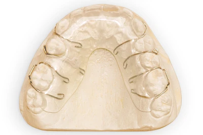 Beispiele: Zahnspange, Multiband, Retainer & Aligner