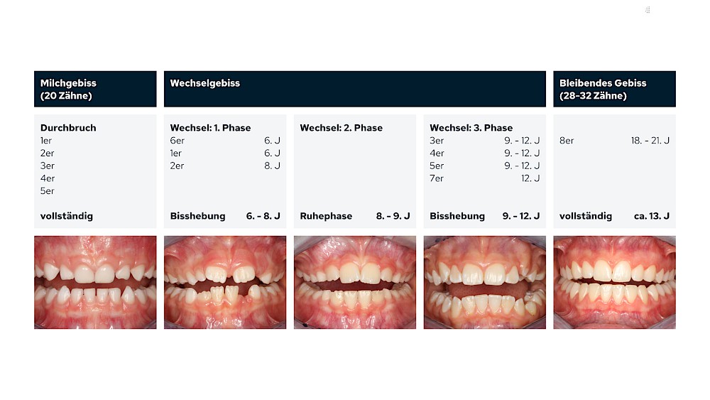 Gebissentwicklung