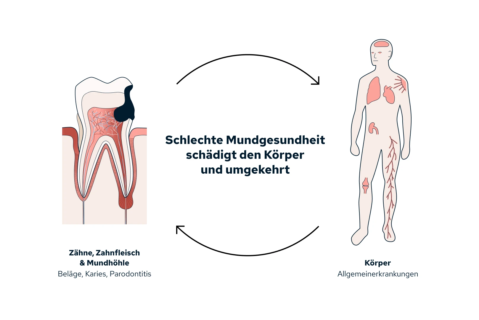 Zusammenhänge Mund- & Allgemeinerkrankungen
