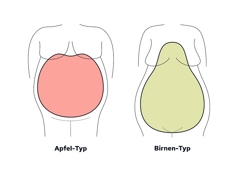 Apfel- oder Birnentyp?