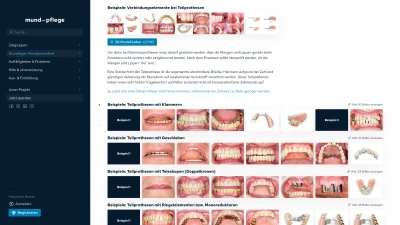 Presse Zahnärztliche Versorgungen: Zahnprothesen Beispiele (.png)