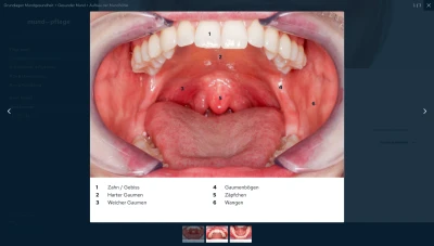 Presse Gesunder Mund: Galerie (.png)