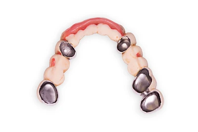 Beispiele: Prothesenstomatitis