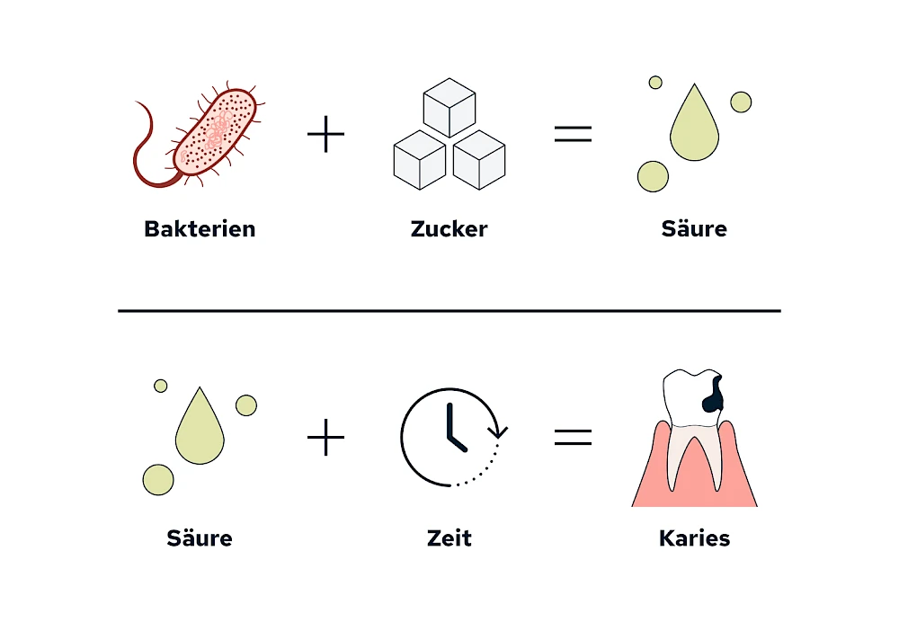 Karies: Entstehung